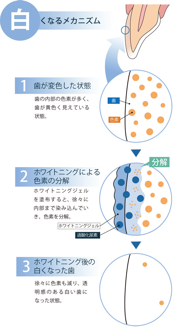 mechanism